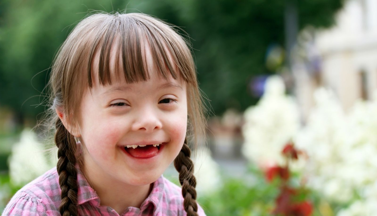 Downs Syndrome Characteristics